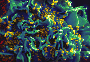 http://commons.wikimedia.org/wiki/File:HIV_H9_T-cell_II.jpg