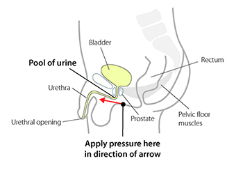 Post micturition diagram